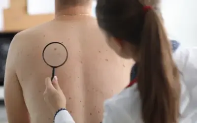 Bones notícies davant el càncer cutani