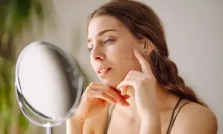 Romandre atents a les pigmentacions facials